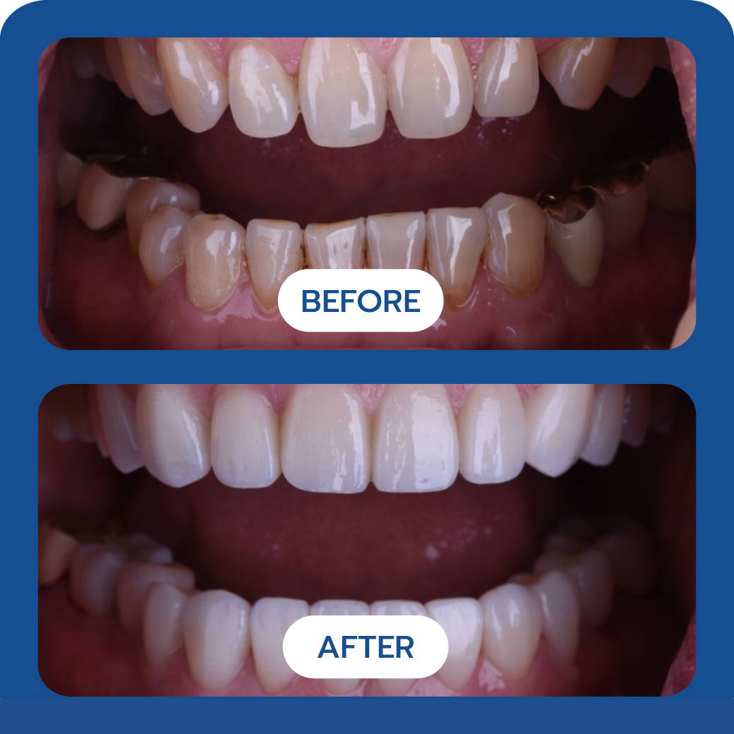 Before and After Case 5